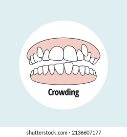 Crowding. Dental problem vector illustration. Dental care concept.