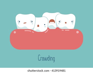 Crowding teeth ,dental concept