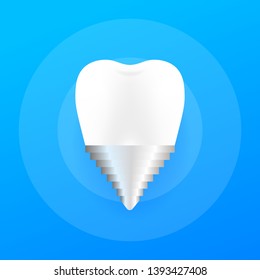 Crown Implant Tooth Icon. Human dental implant. Vector illustration.