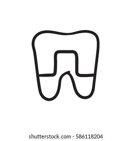 Crowned tooth vector sketch icon isolated on background. Hand drawn Crowned tooth icon. Crowned tooth sketch icon for infographic, website or app.