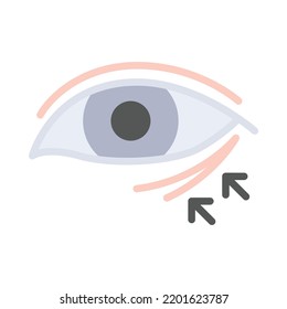 Crows feet surgery flat design. Rejuvenation of wrinkles around the eyes. For plastic surgery clinic, medical and beauty publications. Vector Illustration.