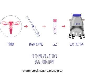 Cryo Preservation Of Eggs. Egg Donation. Egg Retrieval. Scheme Of Egg Donation And Eggs Freezing. Vector Illustration.