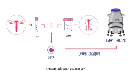 Cryo Preservation Of Embryo. Egg And Sperm Donation. Sperm Banking. Embryo Freezing. Vector Illustration.
