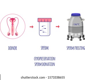 Cryo preservation of sperm. Sperm donation and banking. Scheme of sperm donation and freezing. Vector illustration.