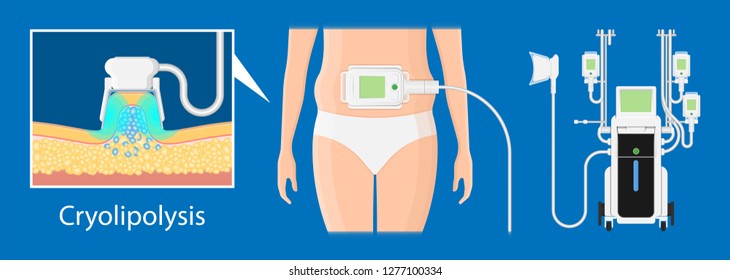 cryolipolysis fat freezing procedure cold treatment non invasive medication reduce temperature break down fat cells removal cosmetic surgery adipose  liposuction Coolsculpting
