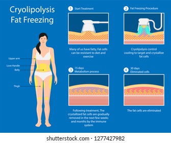 cryolipolysis fat freezing procedure cold treatment non invasive medication reduce temperature break down fat cells removal cosmetic surgery adipose  liposuction Coolsculpting