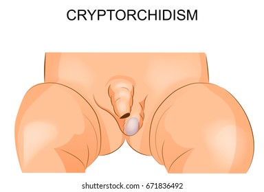 Stretching Your Testicles Stretching Your Testicles