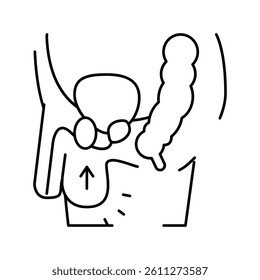 cryptorchidism disease line icon vector. cryptorchidism disease sign. isolated contour symbol black illustration