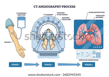 CT angiography process shows IV contrast injection, CT scanner, and 3D artery visualization, illustrating blood vessel imaging steps. Outline diagram
