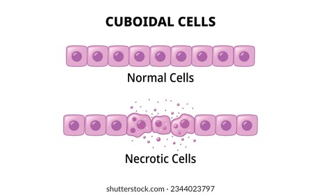 Células Cuboidales - Célula Normal - Celda Necrótica - Ilustración del vector médico