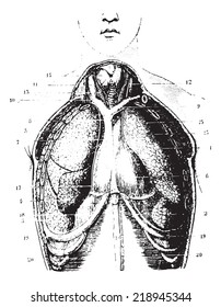 Cup destiny has chest area show available pericardium, pleura and Lungs, vintage engraved illustration. Usual Medicine Dictionary - Paul Labarthe - 1885. 