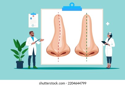 Curva y nariz, rinoplastia quirúrgica, curvatura nasal correctora. Nariz antes y después del tratamiento. Ilustración vectorial plana.