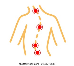 Curved human spine. Poor posture. Symbol. Vector illustration.