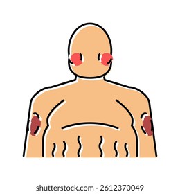 cushing disease endocrinology color icon vector. cushing disease endocrinology sign. isolated symbol illustration