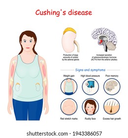 Cushing's disease. Signs and symptoms of Cushing syndrome. Vector illustration