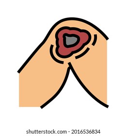 cutaneous mucormycosis color icon vector. cutaneous mucormycosis sign. isolated symbol illustration