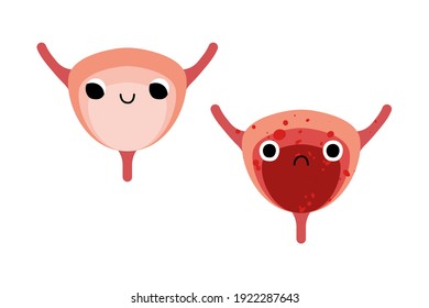 Cute bladders characters with smiling and sad face. Funny kawaii human internal organ with eyes. Healthy and illness insides, bladder disease. Urology. Vector flat cartoon illustration