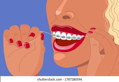 Cute blonde young woman with braces uses dental floss. Daily dental care. Correction of bite and a beautiful smile. Dental health and orthodontics. Stock vector flat illustration.