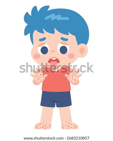 Cute Boy with Rash on Hands, Feet, and Tongue – Flat Cartoon Vector Illustration