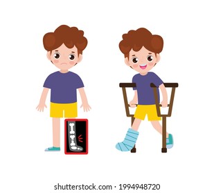 Cute Cartoon Asian Children Broken Leg Stock Vector (Royalty Free ...