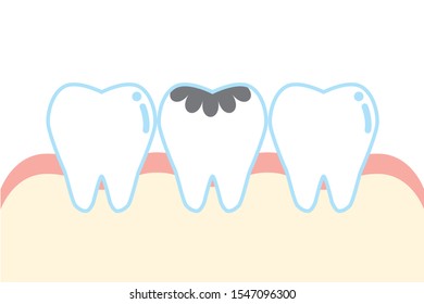 cute cartoon decayed tooth illustration