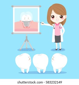 cute cartoon dentist with tooth and implant