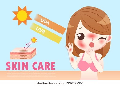 the cute cartoon girl has sunburn problem 