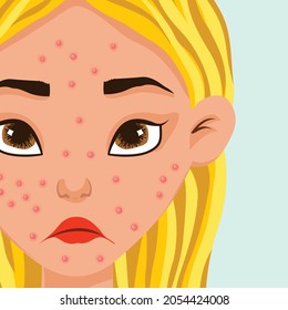Cute cartoon girl taking care of her acne prone skin. Skincare routine vector icon set.