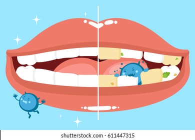 cute cartoon mouth with clean problem before and after