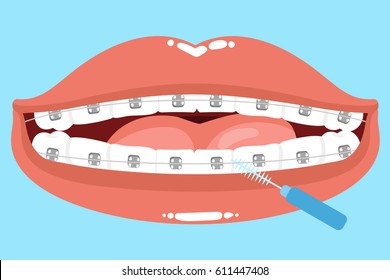 cute cartoon mouth and tooth wear brace with interdental brush