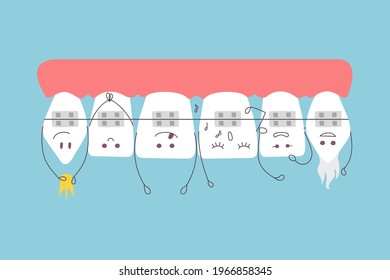 Cute cartoon teeth with braces are hanging upside down