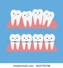 cute cartoon teeth with braces for kids, vector 