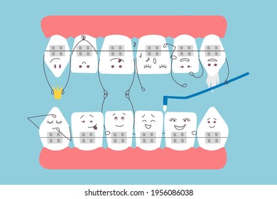 Cute cartoon teeth with braces. upper and lower dentition are communicate