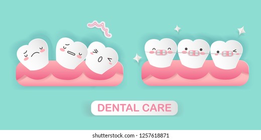 cute cartoon tooth with brace correction concept