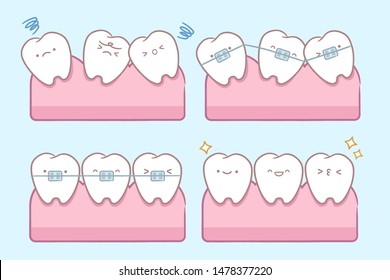 cute cartoon tooth with brace correction concept on blue background