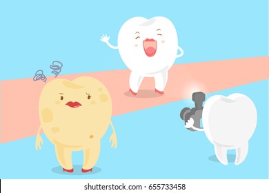 cute cartoon tooth with decay problem and paparazzi on the blue background