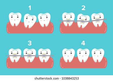 cute cartoon tooth wear brace on the blue background