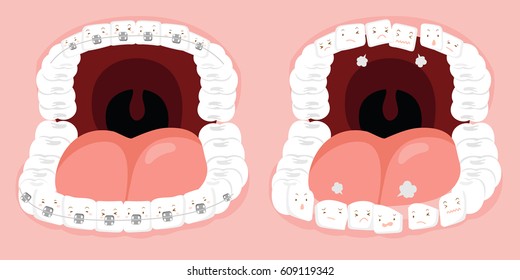 cute cartoon tooth wear brace with arranged irregularly problem