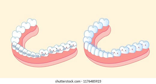 cute cartoon tooth wear different brace on white background