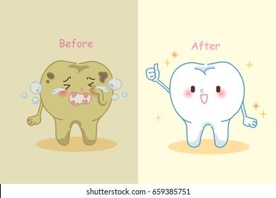 cute cartoon tooth whitening before and after