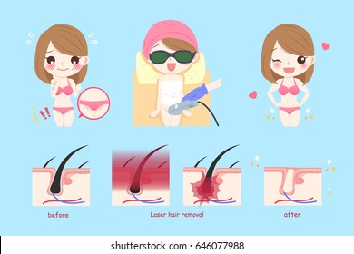 cute cartoon woman with laser bikini line hair concept