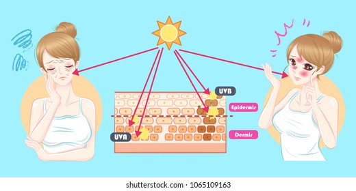 cute cartoon woman with sunburn problem on blue background