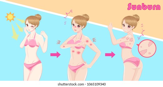 cute cartoon woman with sunburn problem in the summer