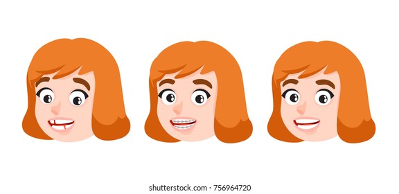 Cute Girl Before And After Dental Teeth Braces Correction. Cartoon Style Vector Illustration