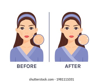 245 Girls checking skin cartoon Images, Stock Photos & Vectors ...