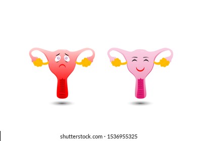 cute and happy Fallopian. sad and not happy Fallopian. Human anatomy Female reproductive system, female reproductive organs.