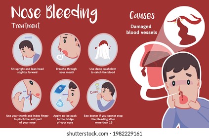 Cute Info Graphic About Nose Bleeding Cartoon Vector