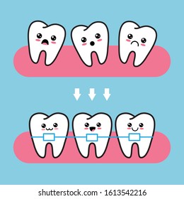 Cute kawaii tooth characters before and after brace correction