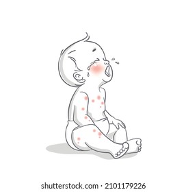 Cute Little Baby With Skin Problem Sitting On Floor And Crying. Vector Cartoon Illustration