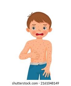 Cute Little Boy Scratching His Itchy Arm Suffering From Measles Rash Allergy Skin